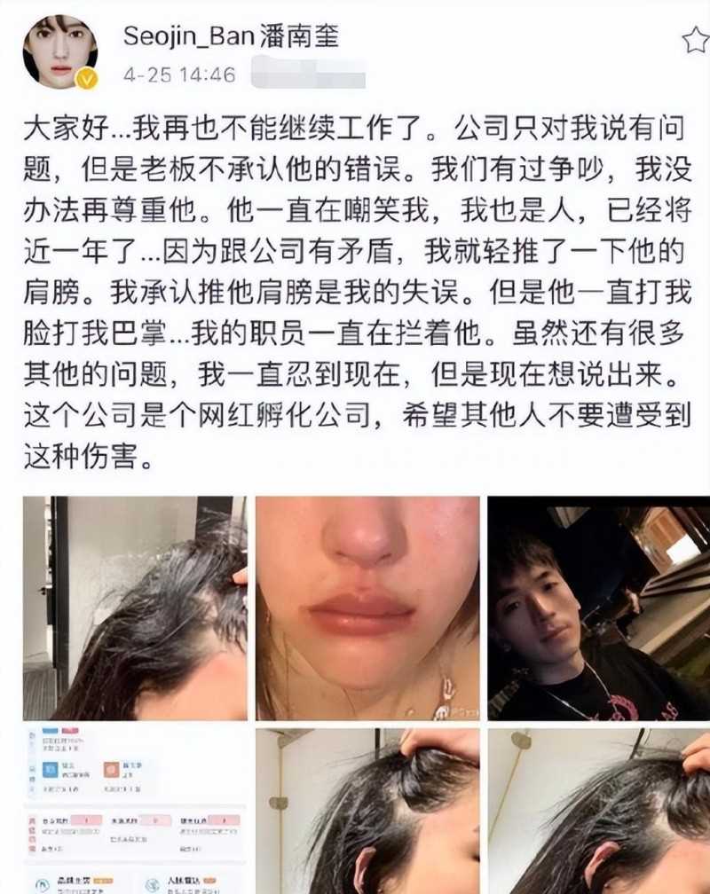 潘南奎为什么叫花蛇（潘南奎卷走前夫10亿整容）