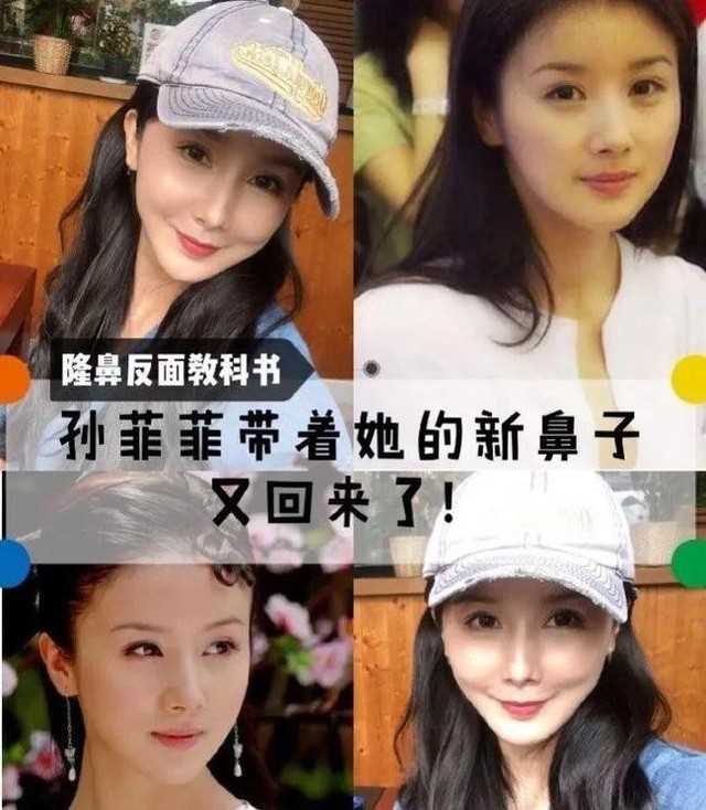 整容明星有哪些失败（娱乐圈10位被整容毁掉的女星）