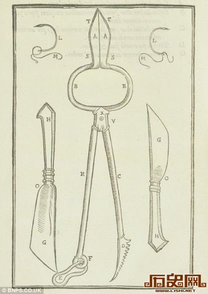 该书甚至展示了手术所用的工具