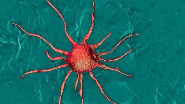 病理检测出癌细胞就是癌症吗