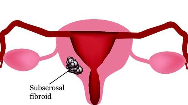 多少宫颈癌是HPV引起的