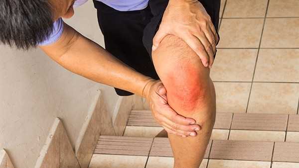 大腿胯骨滑膜炎的症状有哪些