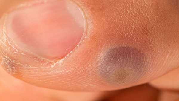 滑石粉对皮肤的作用是什么