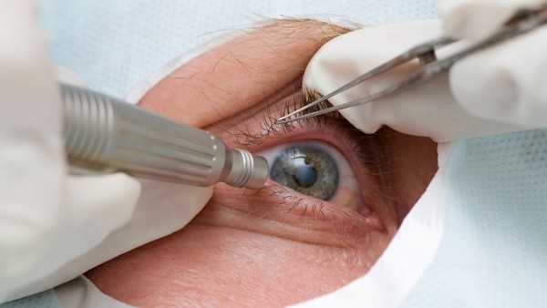 视网膜脱落后白内障如何治疗
