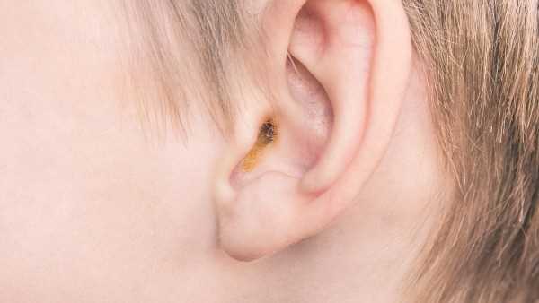 做完胆脂瘤手术后，耳朵里塞的是什么东西