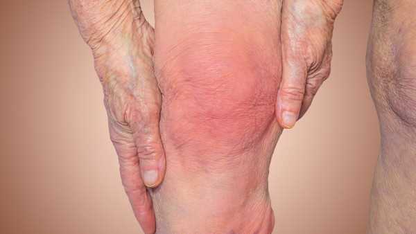 脚背骨质增生的症状是什么