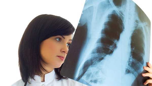 肺癌晚期患者最怕哪三个征兆