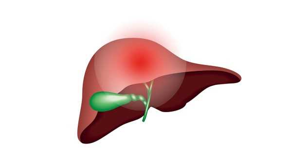 急性肝炎的治疗方案是什么