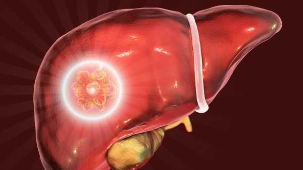 急性重型肝炎发生肝萎缩的主要原因是什么