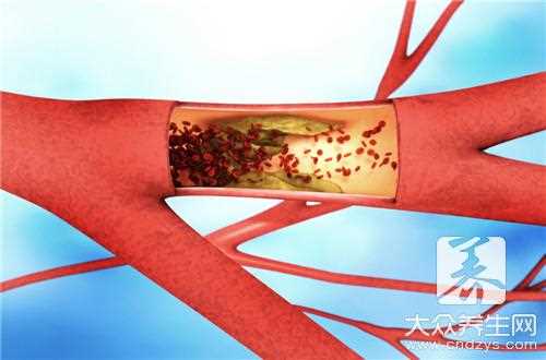 微细血管堵塞怎么治疗