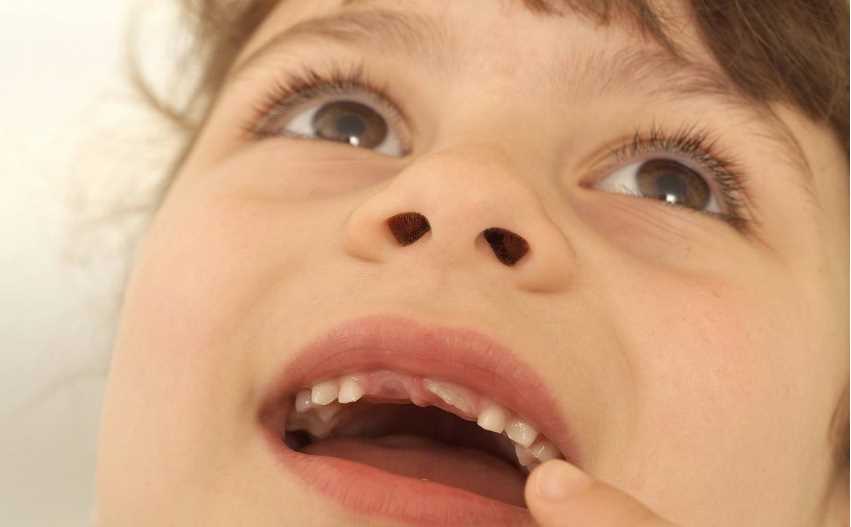 孩子有氟斑牙是什么原因 为什么孩子会长氟斑牙