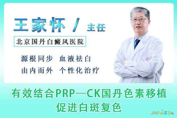 北京国丹白癜风医院：夏季日常养生指导与康复保健方案