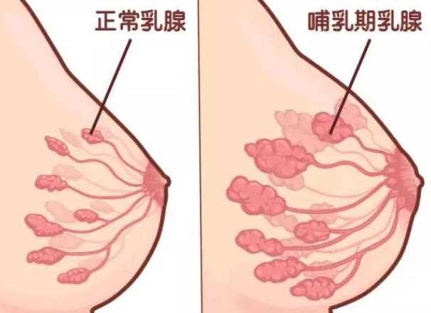 如何预防乳腺炎 如何保护乳房