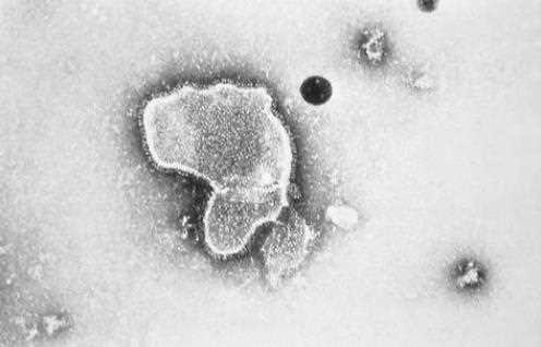 感染合胞病毒必须治疗吗 感染合胞病毒怎么做雾化