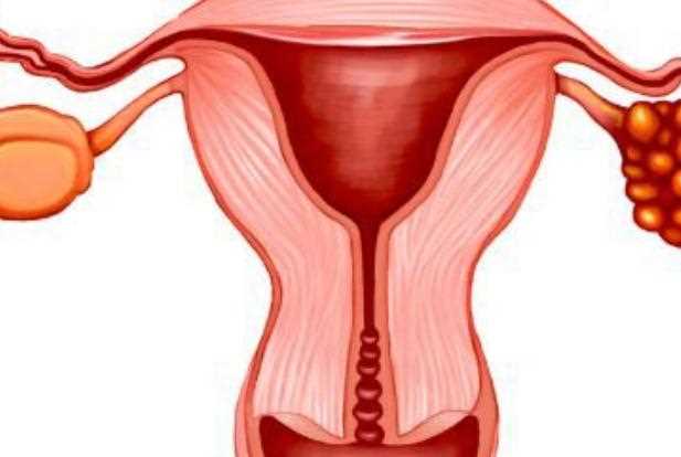 卵巢癌的早期症状有哪些？如何预防卵巢癌？