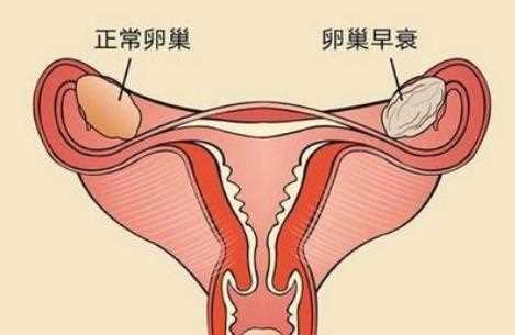 查卵巢功能做什么检查 卵巢