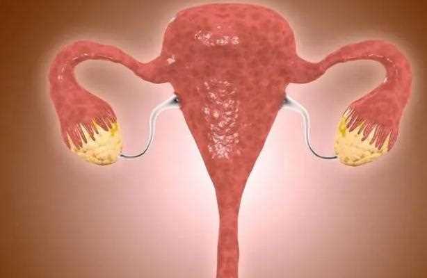 适当运动预防卵巢癌？什么人容易得卵巢癌？