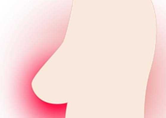 乳腺结节需要做手术吗 恶性