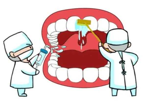牙周炎的症状表现 炎症牙龈
