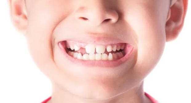 小孩大牙烂了有洞需要修补吗 9岁小孩牙齿有洞需要补