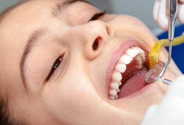 牙酸能洗牙吗 洗牙能治牙酸吗
