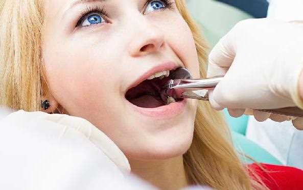 急性牙髓炎能不能拔牙 急性牙髓炎会疼多久