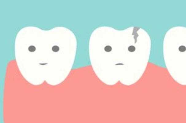 中医如何治疗牙髓炎 可复性牙髓炎如何治疗
