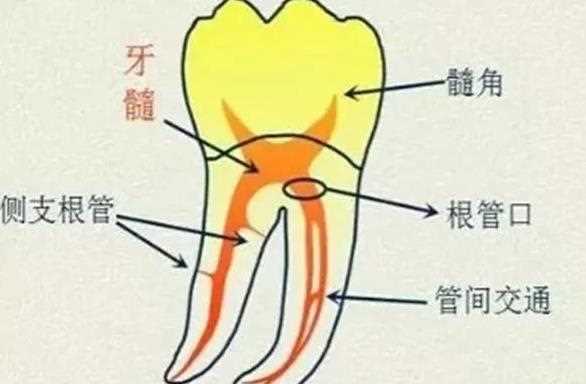 补过的牙齿会得牙髓炎吗 补过的牙牙髓炎怎么办