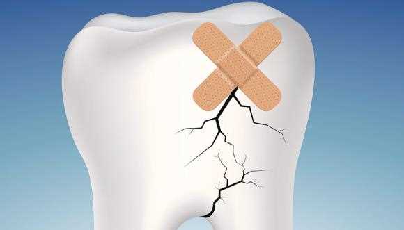 牙髓炎会一直疼下去吗 牙髓炎不治会一直疼吗