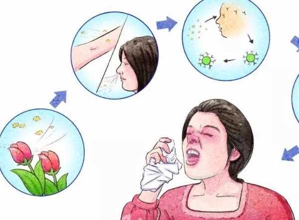过敏性鼻炎能隆鼻吗 过敏性