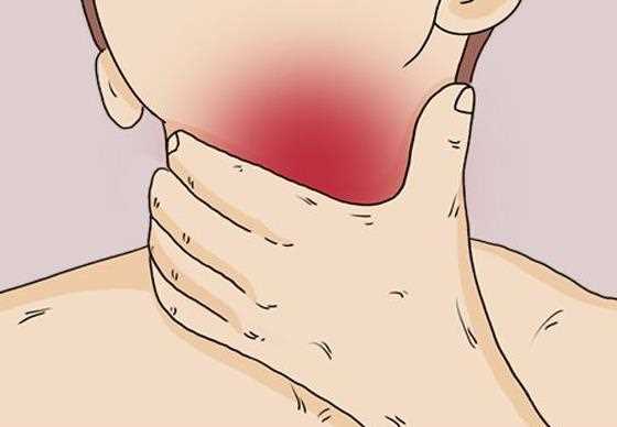 多年慢性咽炎能治愈吗 多年慢性咽炎怎么治疗