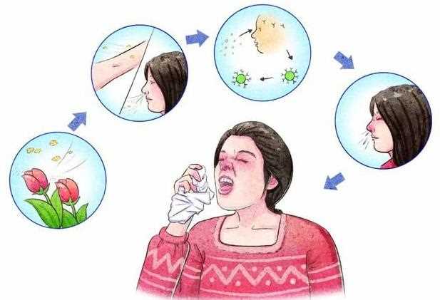 鼻炎换个环境居住会变好吗 鼻炎变好有哪些症状