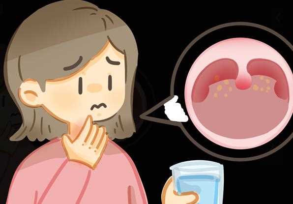 慢性咽炎症状会消失吗 慢性咽炎会导致打鼾吗