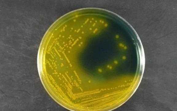 创伤弧菌感染怎么治疗 创伤