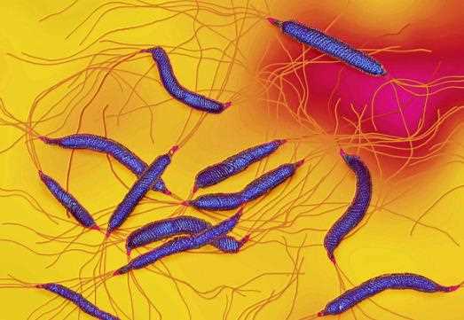 幽门螺杆菌是怎么引起的 家族水源口腔食物生活传染